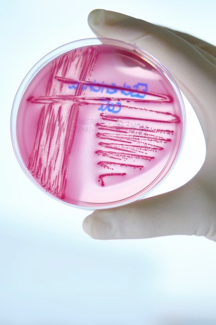 E. coli-Bakterium