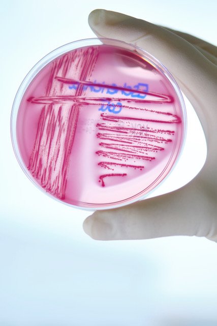 E. coli-Bakterium E. coli-Bakterium